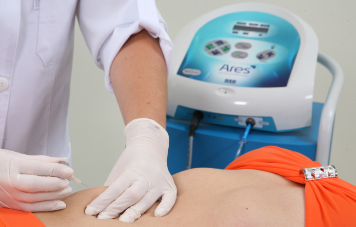 Ibramed produz 35 equipamentos para áreas de fisioterapia, estética e medicina estética. Foto: Divulgação.