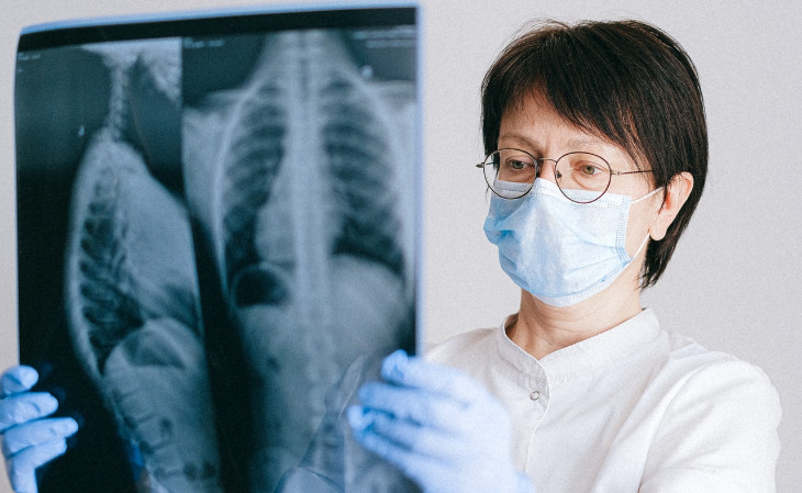 Projeto utilizou radiografias de tórax e dados clínicos para construção do algoritmo. Foto: divulgação.